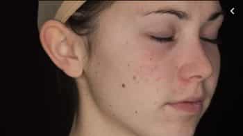 دانلود تکسچر صورت زنانه